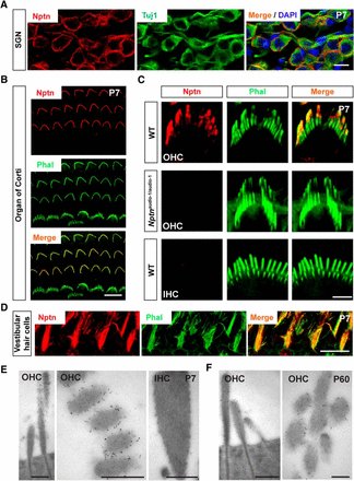 Role for neuroplastin isoform Np55 in the stereocilia of outer hair cells
jneurosci.org/content/36/35/… via @JNeuroscience