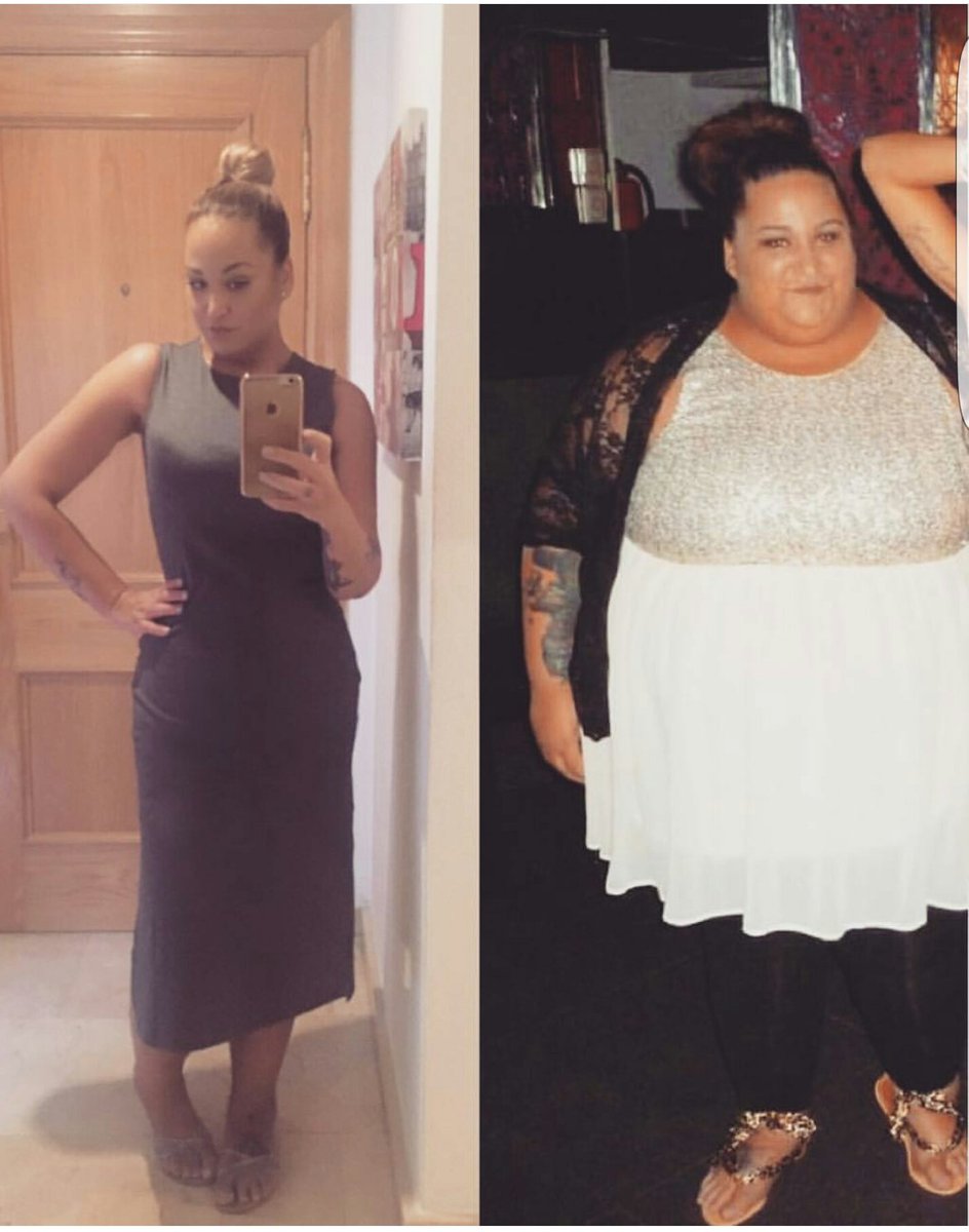 enmachuk's tweet image. O ha puesto las fotos al revés, o asume la derrota con elegancia.