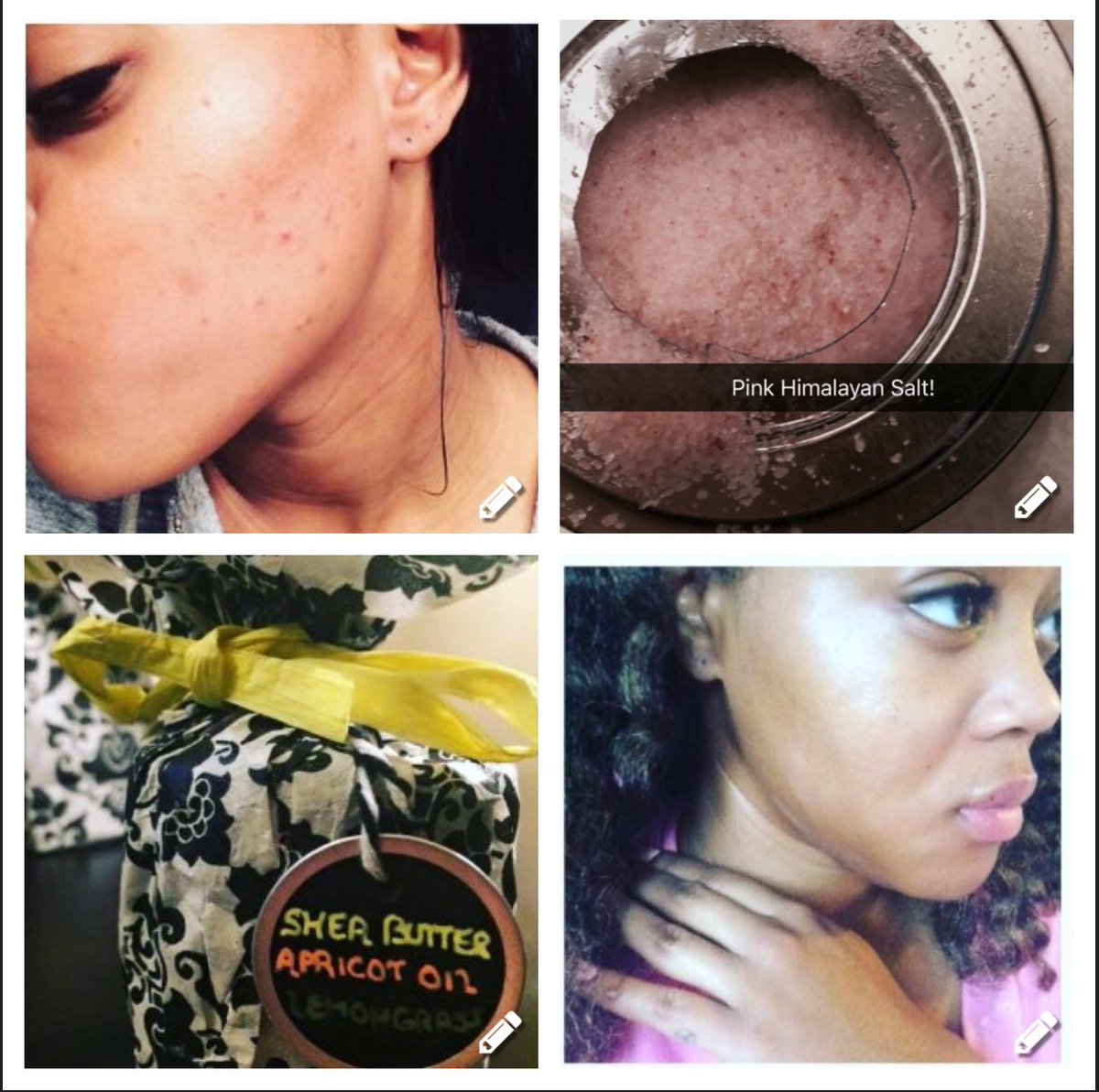 AysiaKami's tweet photo. The results are obvious π #pinkhimalayansalt β #mysecretshea ππDM me for info #beautyblogger #clearskin #melanin https://t.co/JD3UkzqGAz