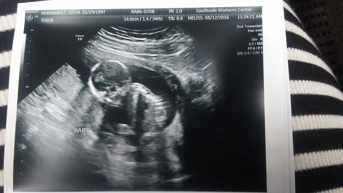 Blessed 🙏👶 <a href="/LeesaMarie3/">LeesaMarieeee</a>