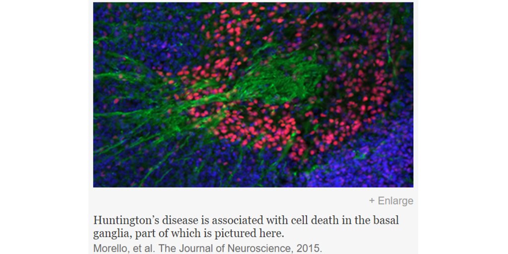 There's no cure for Huntington's disease, but nonhuman primate research models offer promise
bit.ly/2bjFni6