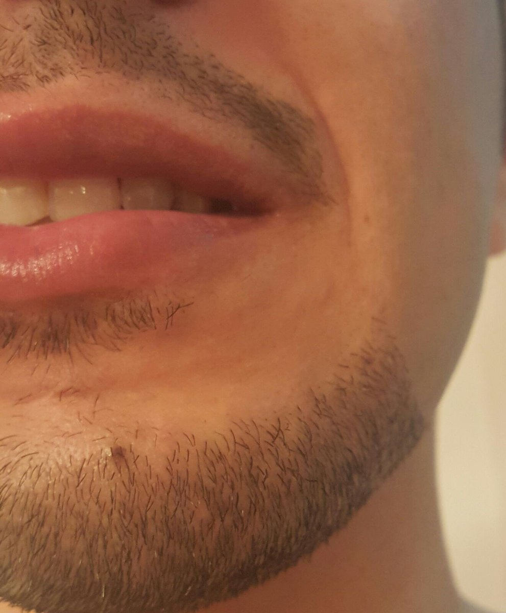 abbccfff's tweet photo. الشفشفه مو عيـب ولاشـيء كلها شـفه بشـفه شـويه مـص ​مع عـض و خلصـنا ي حبكـم لتكبـير الأمـور.. https://t.co/JOQyosiD0W