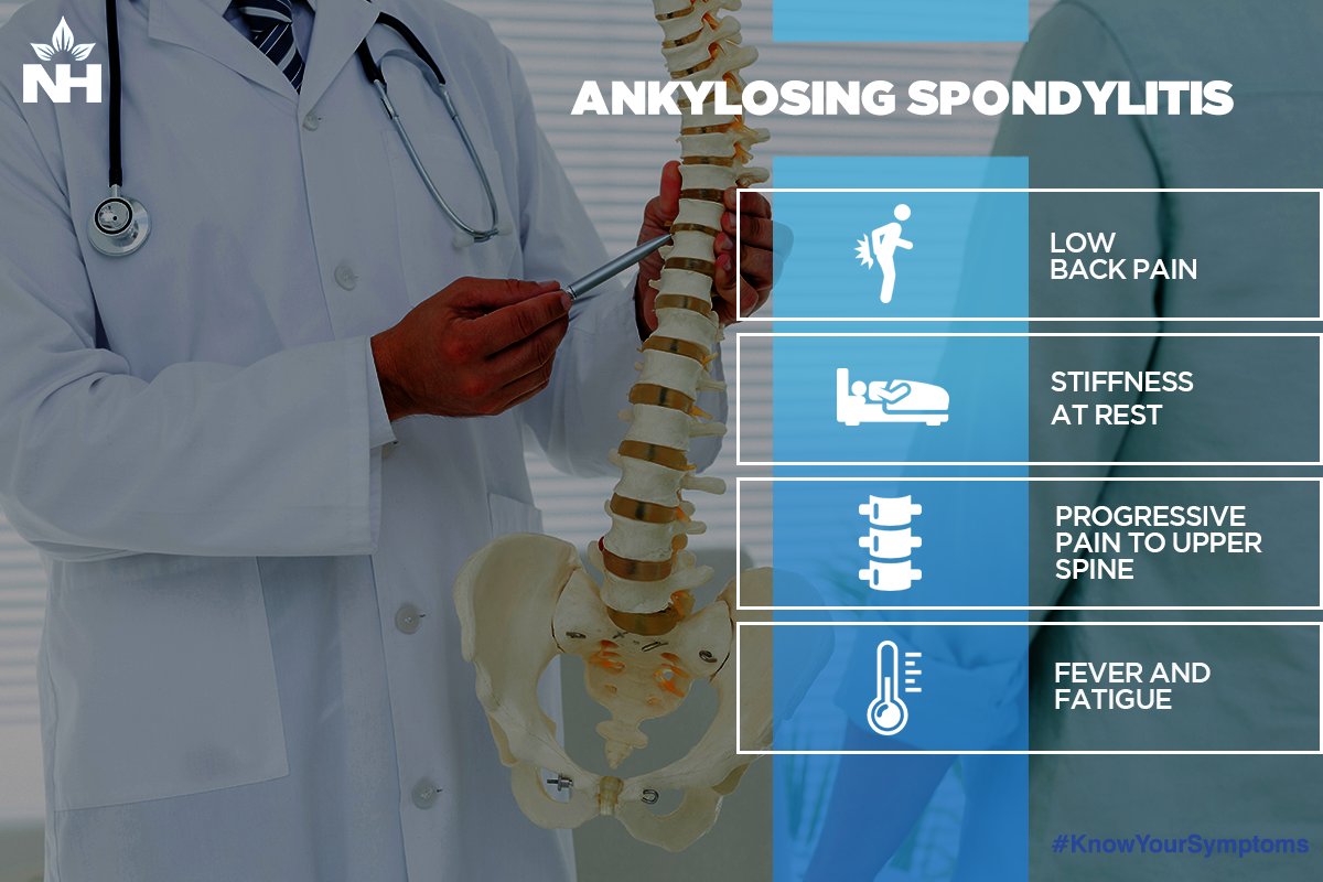 NarayanaHealth's tweet photo. Ankylosing spondylitis is a type of inflammatory arthritis that primarily affects the spine. #KnowYourSymptoms https://t.co/ZcNKUkagaK