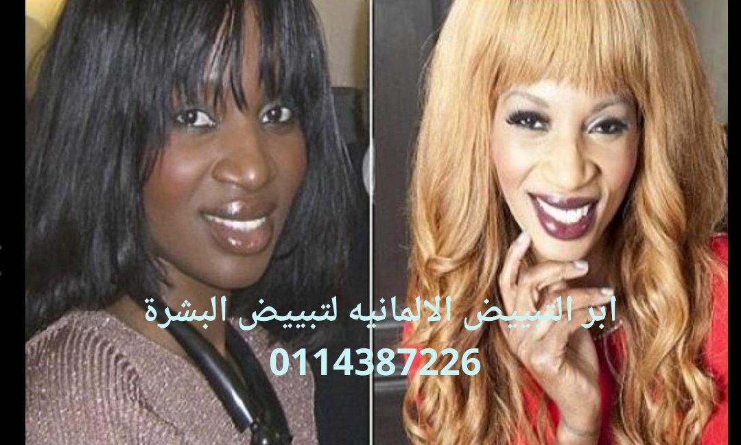 أضرار إبر توحيد لون الجسم حياتك