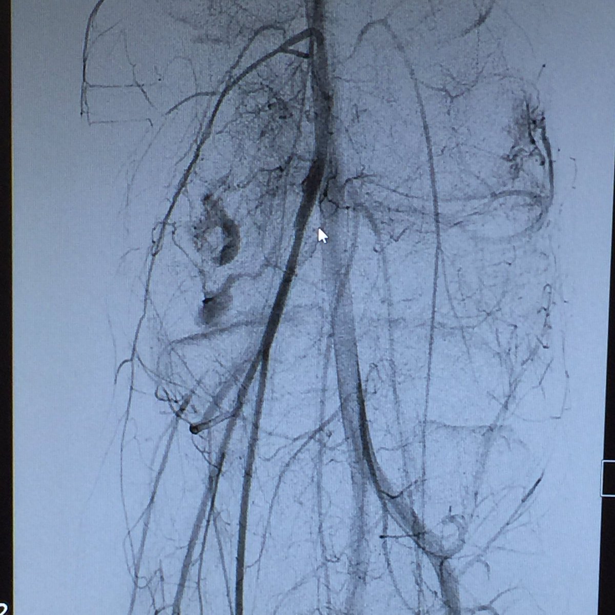 Ahmed Kamel MD, PhD, FSIR tweet media