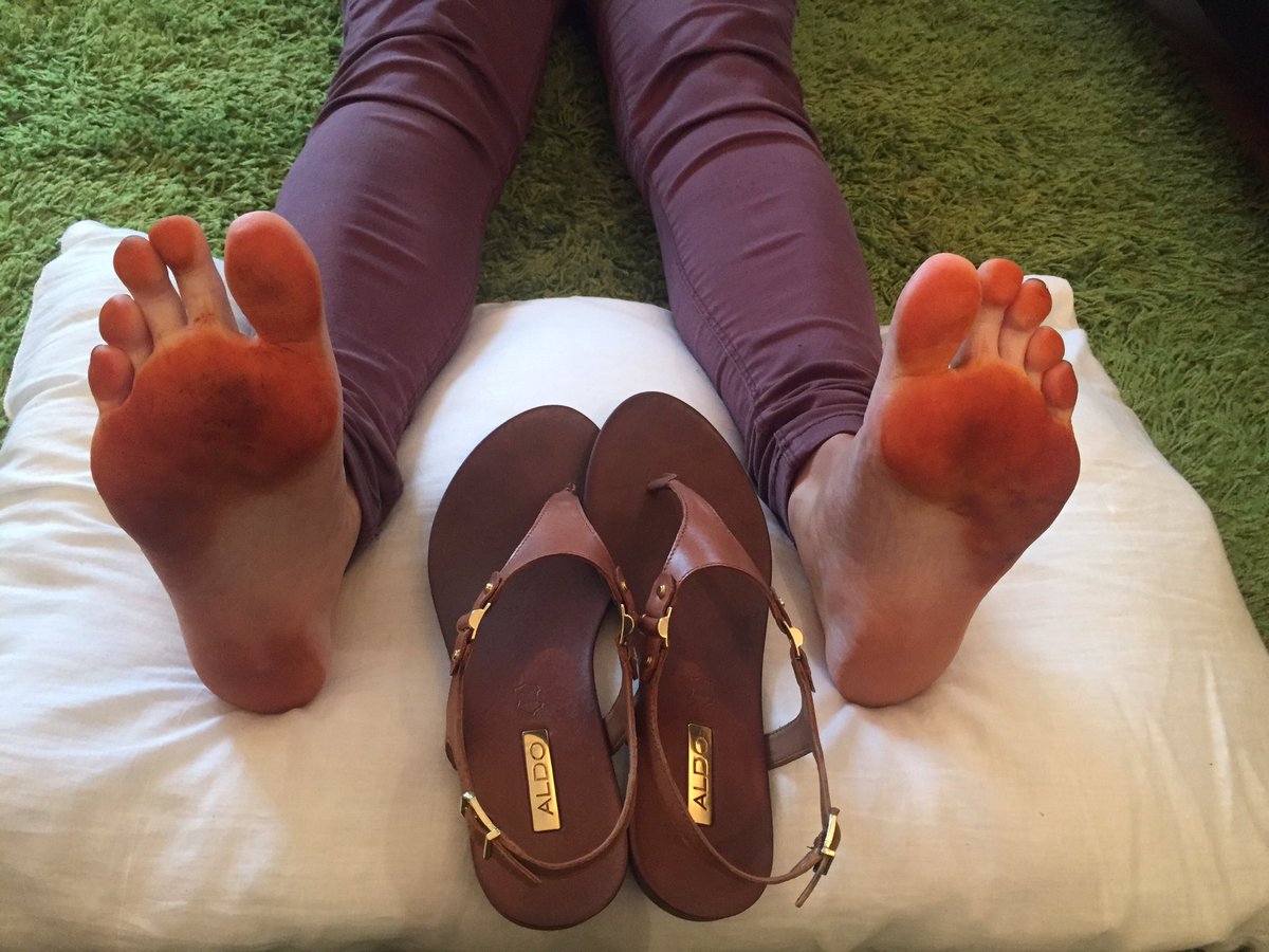 Hmm this is definitely not normal. <a href="/ALDO_Shoes/">ALDO Shoes</a> thanks for the tan but you should leave this up to <a href="/StTropezTan/">St.Tropez</a>! 😳😬