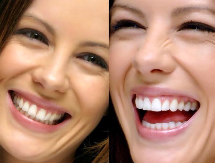 I love your smile and your eyes as you do that so beautifully @KateBeckinsa...