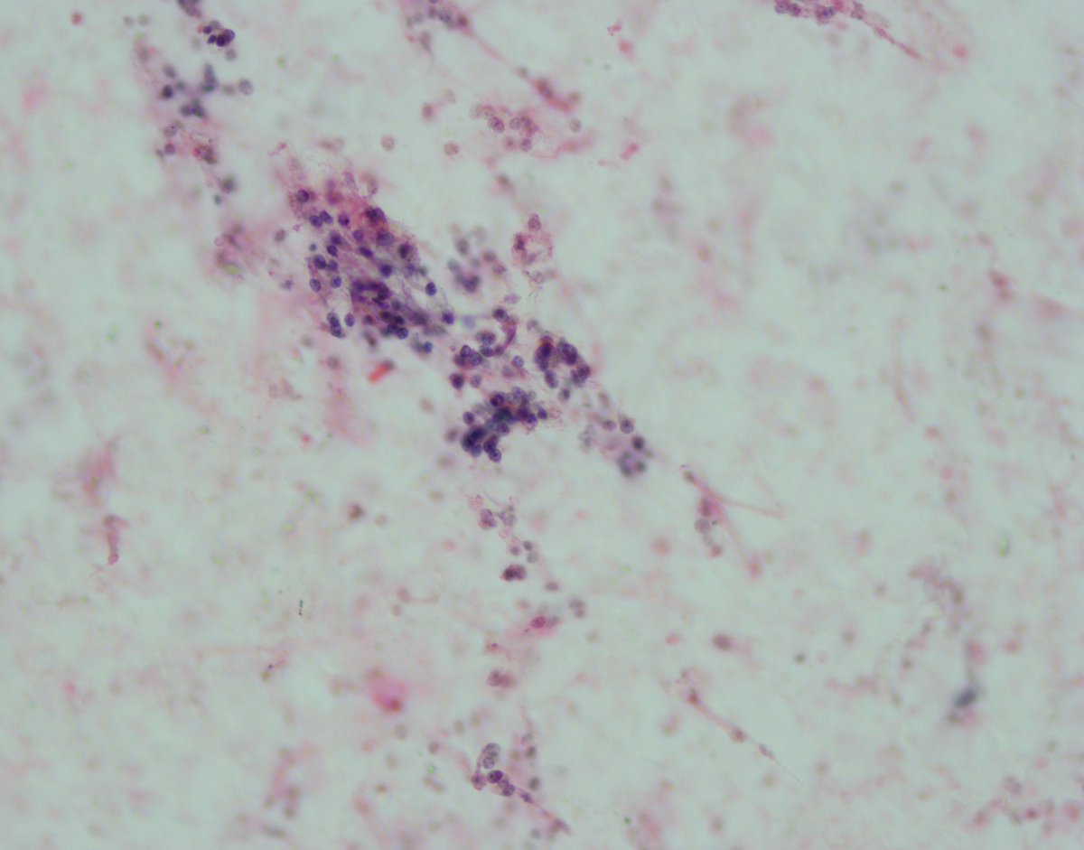 Mayo Clinic Pathology tweet media