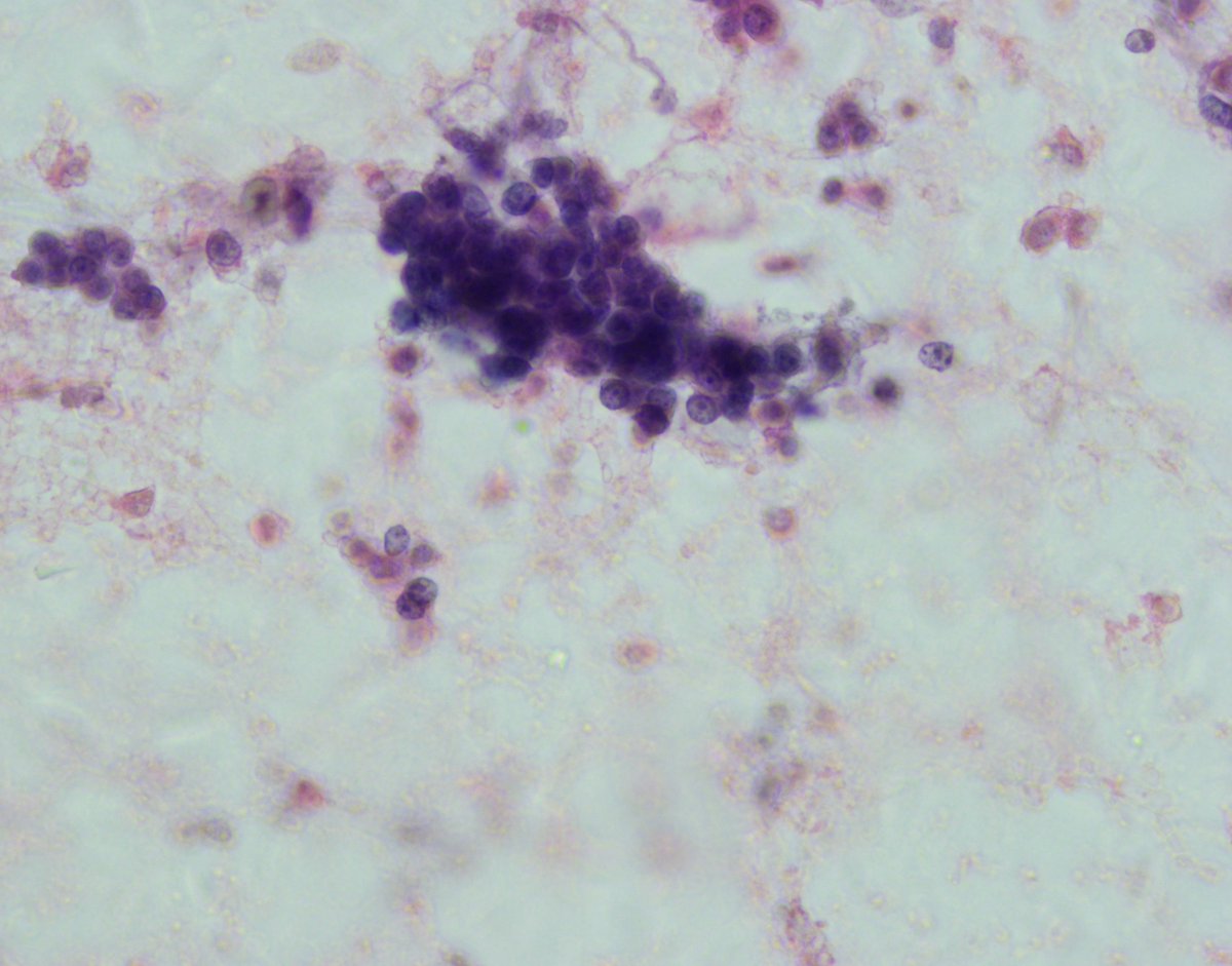 Mayo Clinic Pathology tweet media