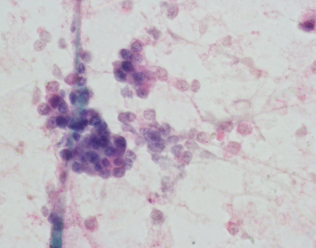 Mayo Clinic Pathology tweet media