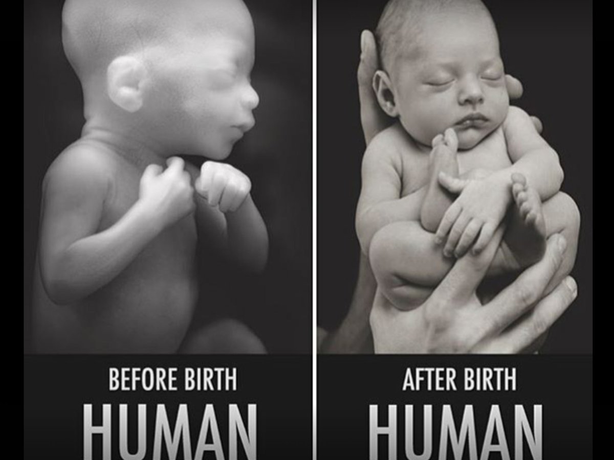 sunbeltgirl's tweet photo. MT @FranCifelli: #DefundPP ~ Stop the murder of innocents. https://t.co/ywn4TdEUIl #UnbornLivesMatter #PJNET