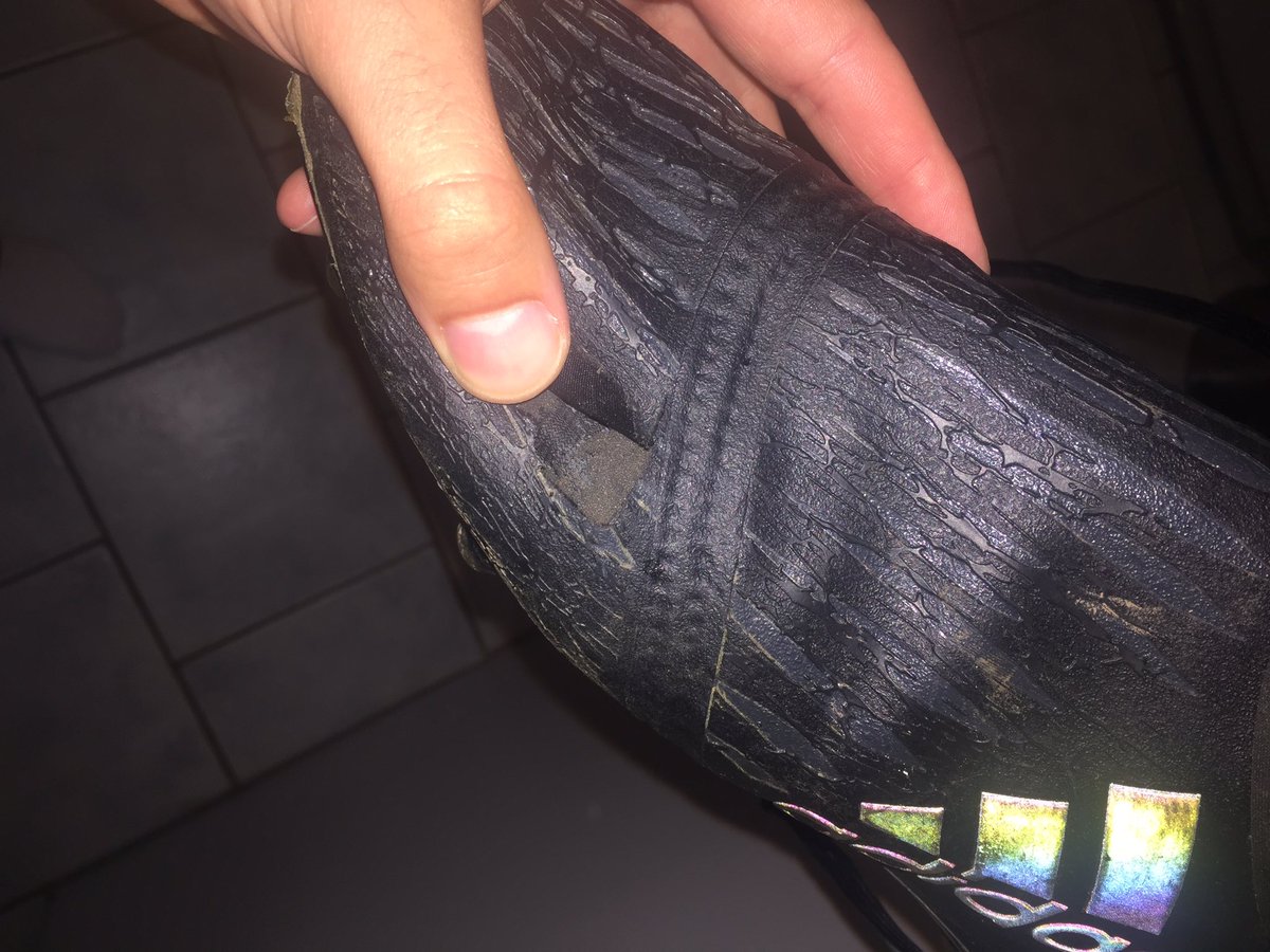 DinoBonwickPT's tweet photo. @ProD_Soccer Gutted to have played 3 games into the season and this happens!? 😭😭 #Adidas #ProDirectSoccer https://t.co/gEomcPsDue