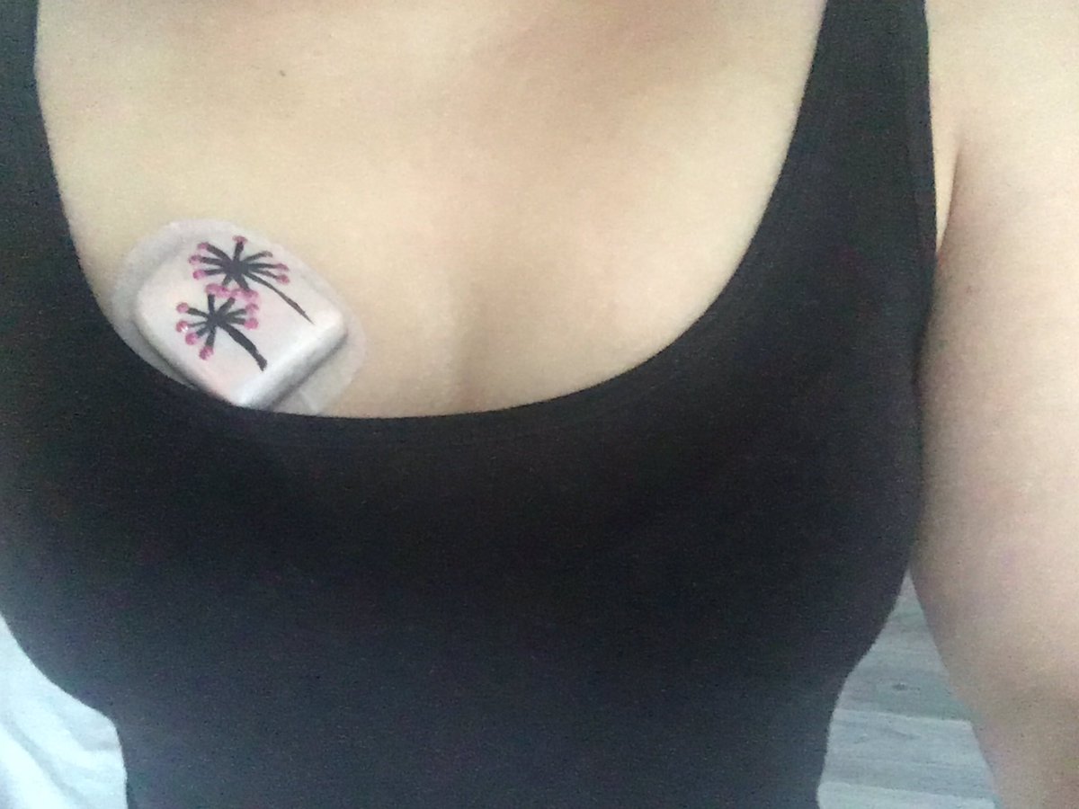 OMG_StanaKatic's tweet image. @AmDiabetesAssn And until someone will find a cure, I&apos;ll make diabetes look beautiful 😉 #PimpMyPod