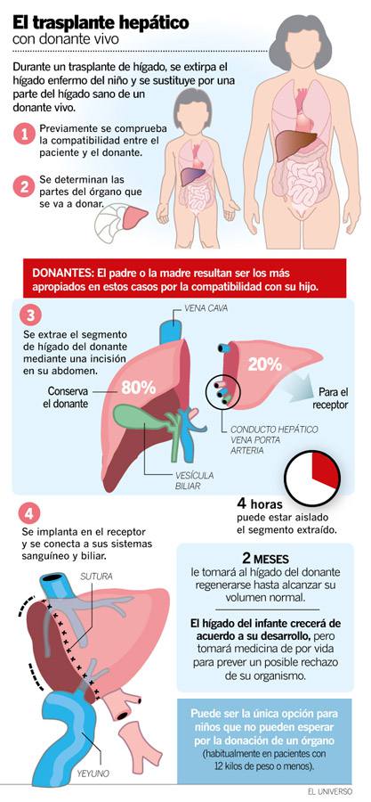 ¿Qué es Trasplante Hepático?. 
#mesporladonacion