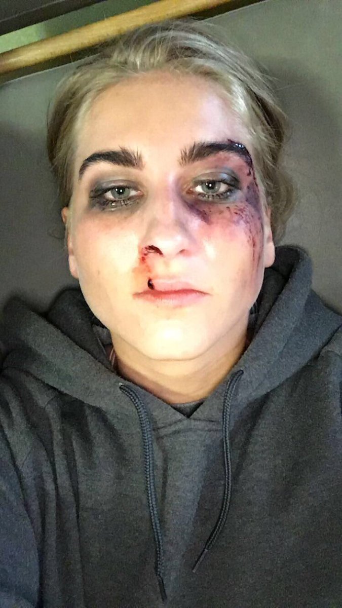 Þegar þú liggur uppí rúmi og missir svo símann á andlitið