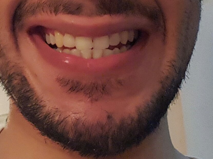abbccfff's tweet photo. ابي اشفشف فحل نحيف ومشعر ورجولي من الشرقيه الدمام حتئ لوكان اجنبي عادي مايهمني ويحب الحنان والشفشفه والحنان 😘😘😘 https://t.co/rTXjq9By8O