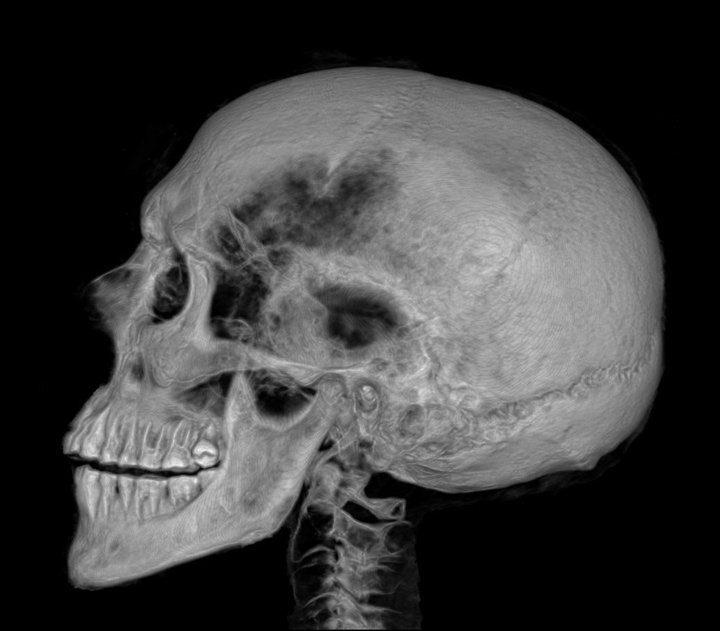 metmuseum's tweet image. A #MetCurator details what modern medical technology can teach us about Ancient Egyptians. met.org/2ca5CWn