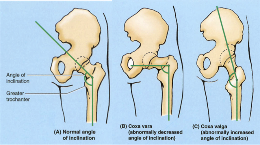 FitnessHacks101's tweet photo. No Two Hips Are The Same: How Anatomical Variance Can Affect Your Range Of Motion https://t.co/Gdy1A3N85k https://t.co/F5NxthbTxm