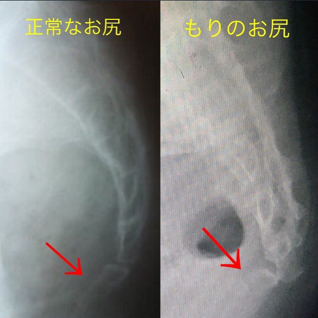 Ikumin Auf Twitter まさかお尻を丸裸にされるとは 曲がってはいけない方向に 割れてはいけないところが割れる 爆笑 ネタ祭り 尾骨骨折 セクシーガール 痛いよー Ikumin Auf Twitter まさかお尻を丸裸にされるとは 曲がってはいけない方向に 割れてはいけないところが割れる 爆笑 ネタ祭り 尾骨骨折 セクシーガール 痛いよー