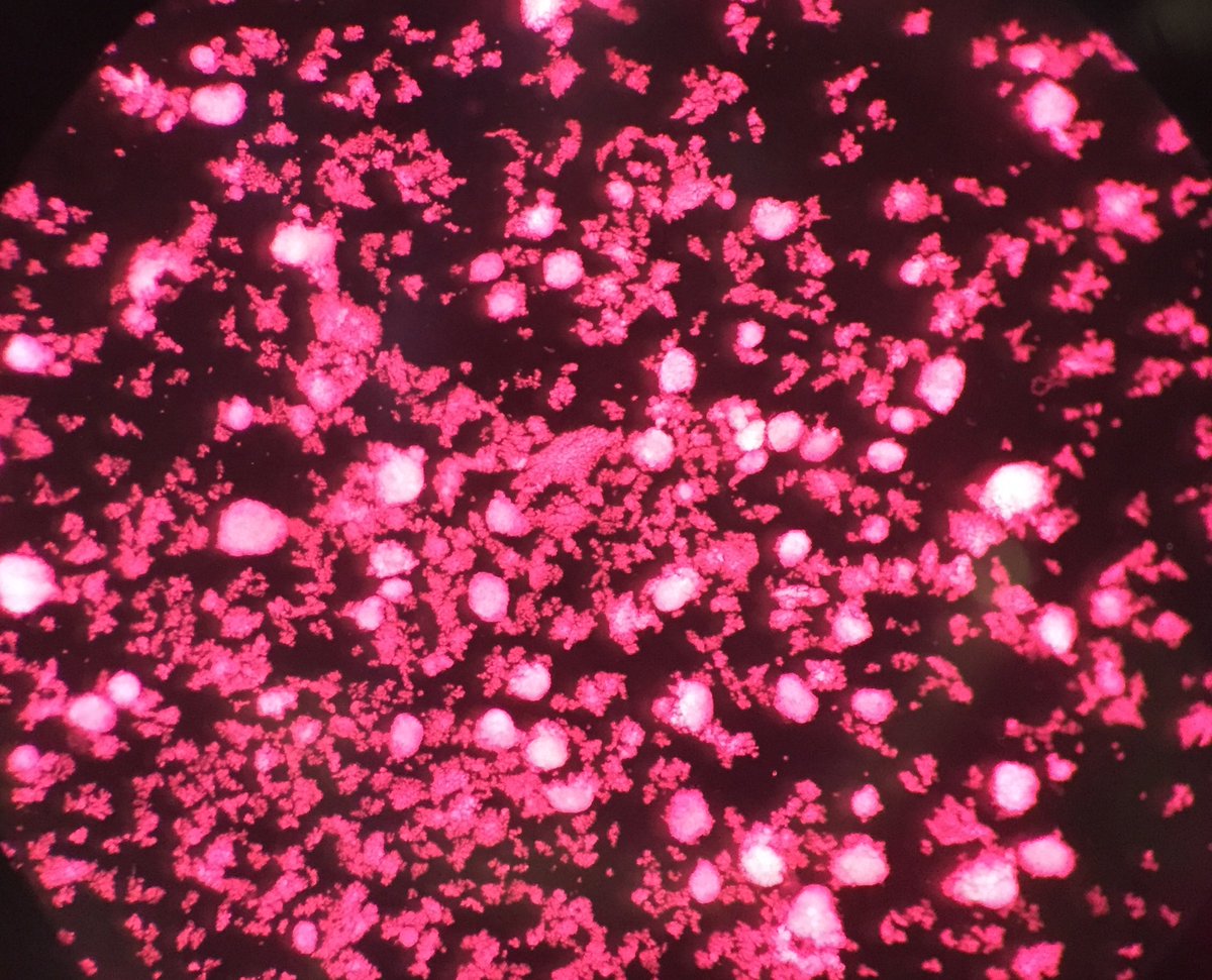 Niveditaseshad2's tweet image. Starting my career in the &quot;islet&quot; biology world.... still half an islet biologist ... excited #islets #not the cleanest and clearest pic!