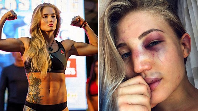 7Sport's tweet photo. .@BellatorMMA star Anastasia Yankova shows off brutal toll of victory. STORY: https://t.co/ueSrBOdlBh #Bellator161 https://t.co/zoERJhQGXm