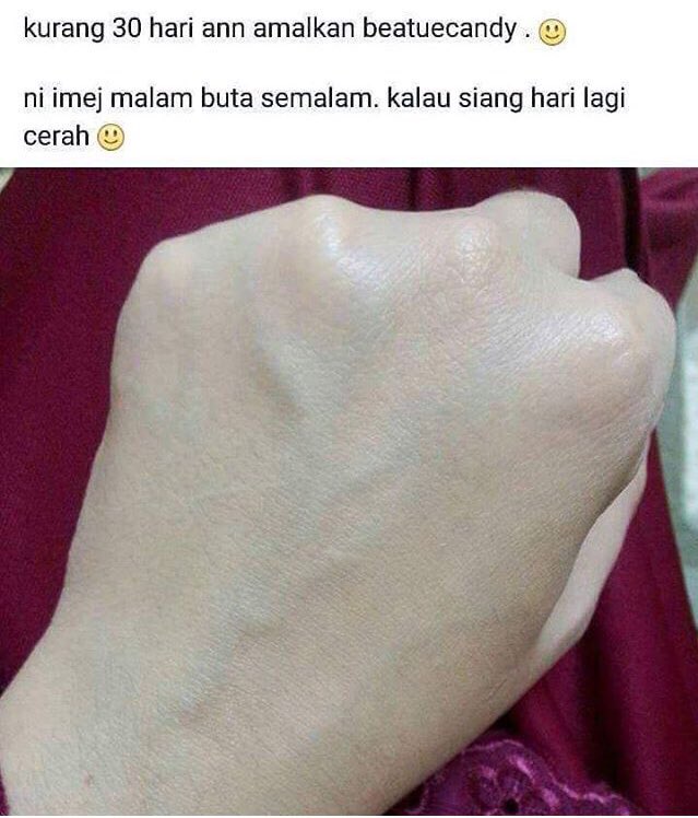 bihangirly's tweet photo. Nak cantik kena melabur. Jangan duduk diam tak buat apa tapi nak putih 😊
Siapa nak putih gebu seluruh badan? 💕 #beautecandy https://t.co/4yvw4zH3Aj
