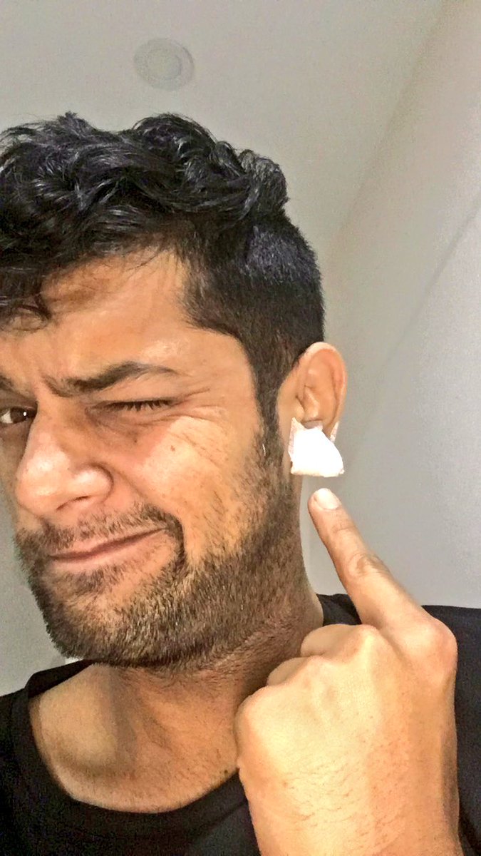 vinayakjoshelay's tweet photo. Ear torn during performance #dancingstar3 Recovering fast. Thanks for love & support @PixelPicturesIN @ColorsKannadaTV #vinayakjoshi https://t.co/ncp2Q6nyjv