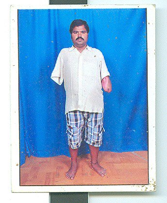 chinnag14's tweet photo. #MemuSaitham please help Mr. Venkateswara Reddy family, he lost his two hands accidentally.
+91 95 73 975449 https://t.co/5RTzuwWZgI