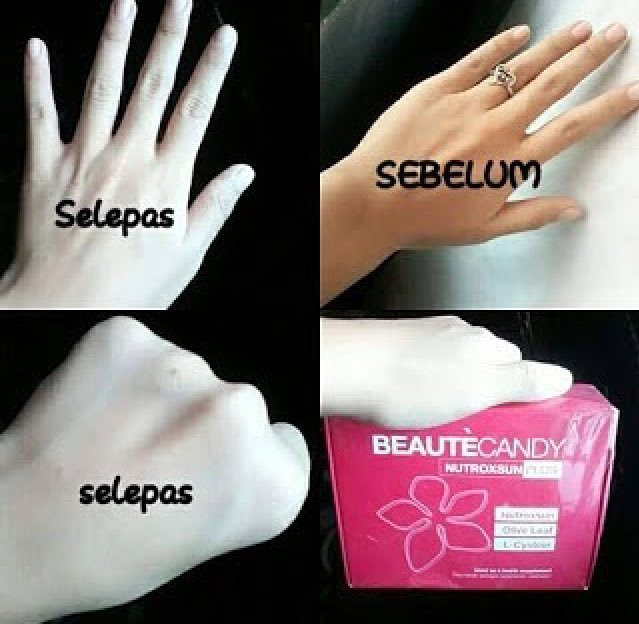 bihangirly's tweet photo. Hi, open order for Beauté Candy.
Putih gebu seluruh badan.
No more jerawat &amp; parut. 
Dm for details 💖 #iklantktk https://t.co/Xi4KstXTjS