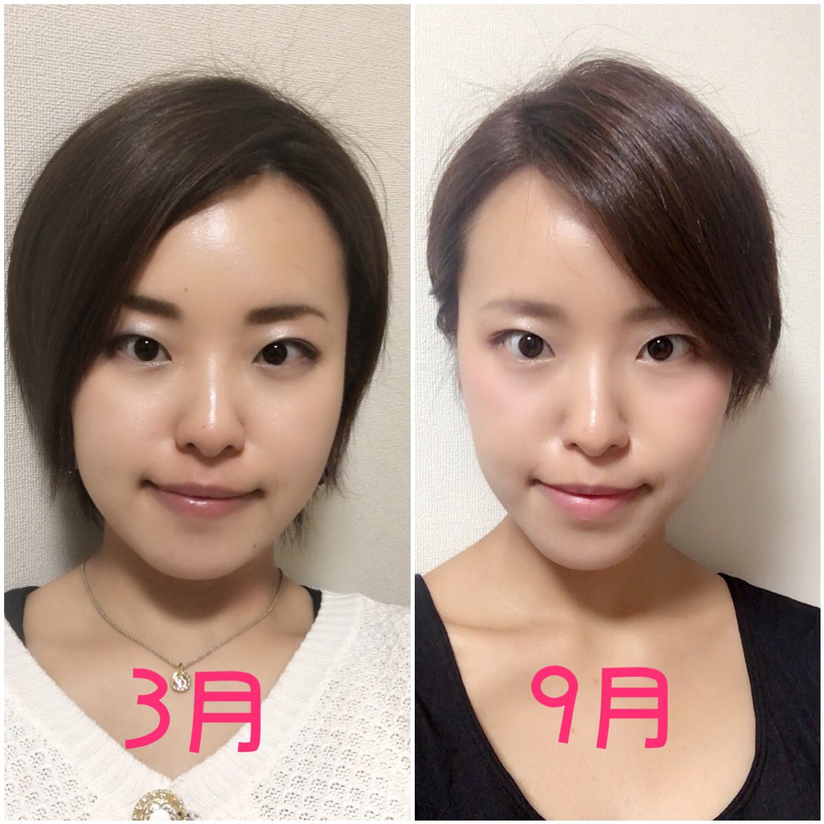 Diet Before After News ダイエット成功者一覧 顔 お腹 脚 美脚に ダイエット成功ビフォーアフター画像 ダイエット成功者一覧 ダイエット ビフォーアフター Reina 0007 T Co Pu1brvjazz