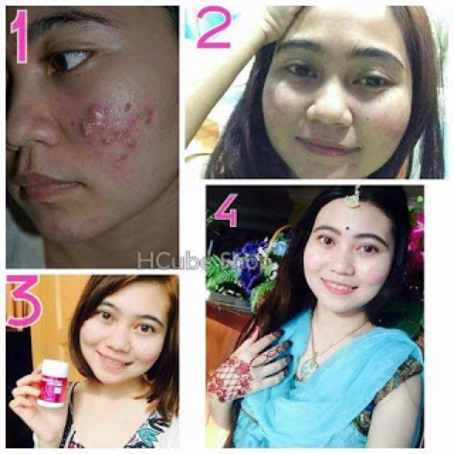 bihangirly's tweet photo. 😘 Putih gebu satu badan, kulit lembut spt baby. No more jerawat dan parut. Hanya dengan Beauté Candy. Dm for details @KuantanTV https://t.co/I7CjVp46Jq