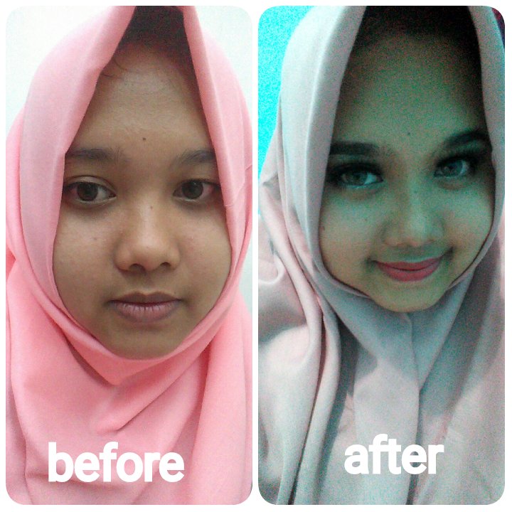 Before and after