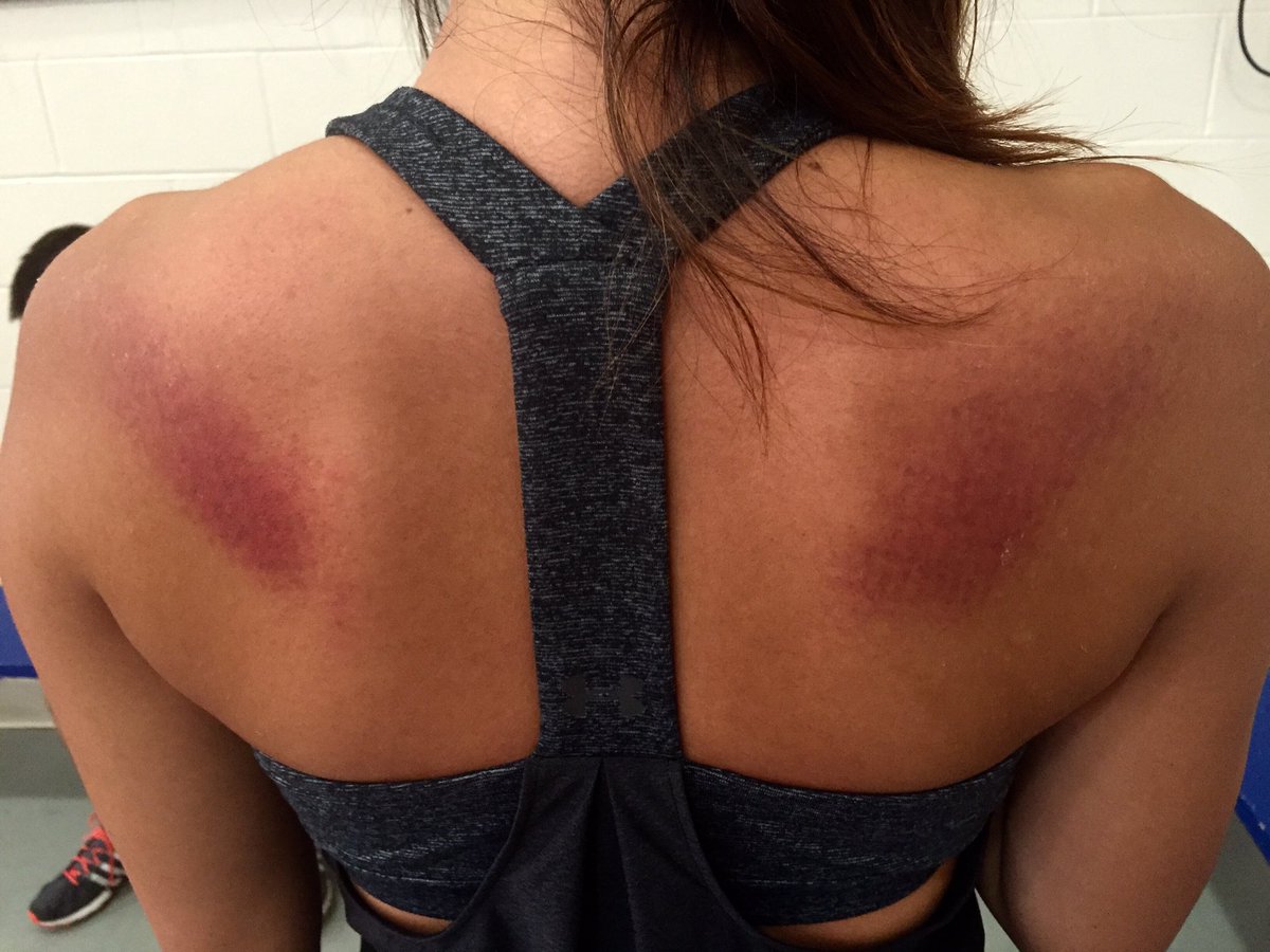 myriamtheriault's tweet photo. ๐๐๐ #trampolineclass https://t.co/eZzf8thqCL