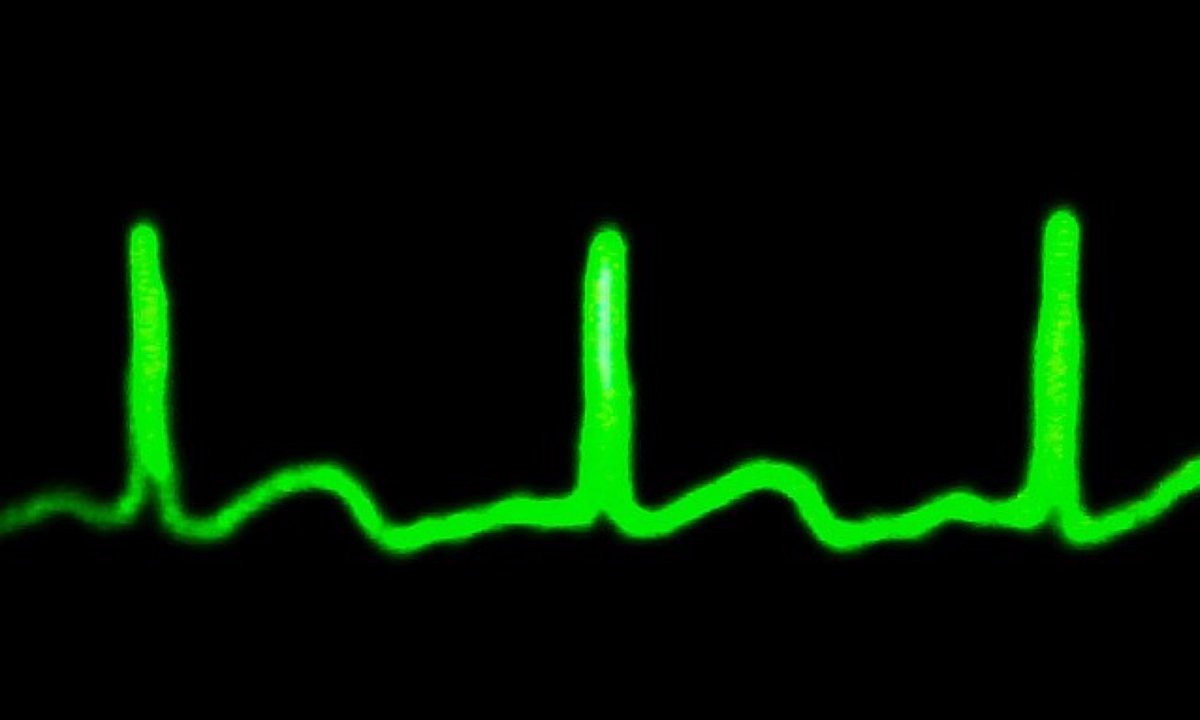 Thinking of products as projects kills your relationship with customers <a href="/craigstrong/">Craig Strong</a> zurb.us/2d9sqDy