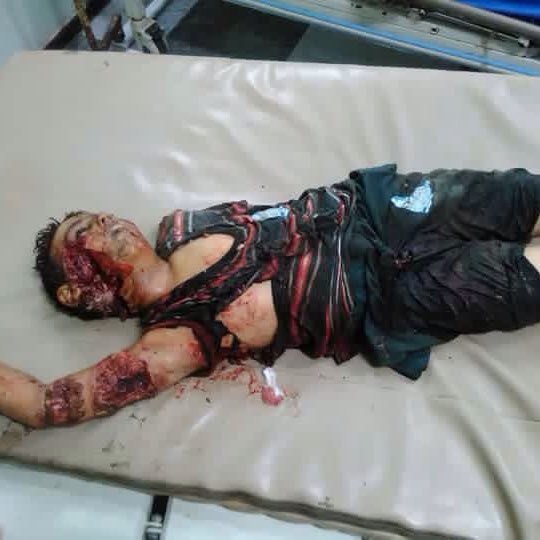 AlialiAnan_ali1's tweet photo. اللهم إن حكام بيتك الحرام قد استحلوا دماءنا دون ذنب ونحن نشهد أن لا إله إلا أنت ونعبدك ونقدسك ولا نشرك بك أحدا https://t.co/NesuRu2xOK