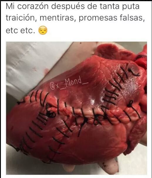 yercardenas's tweet photo. Admirable y aun asi sigue latiendo #NoCreoEnElAmor https://t.co/2vIJlygays