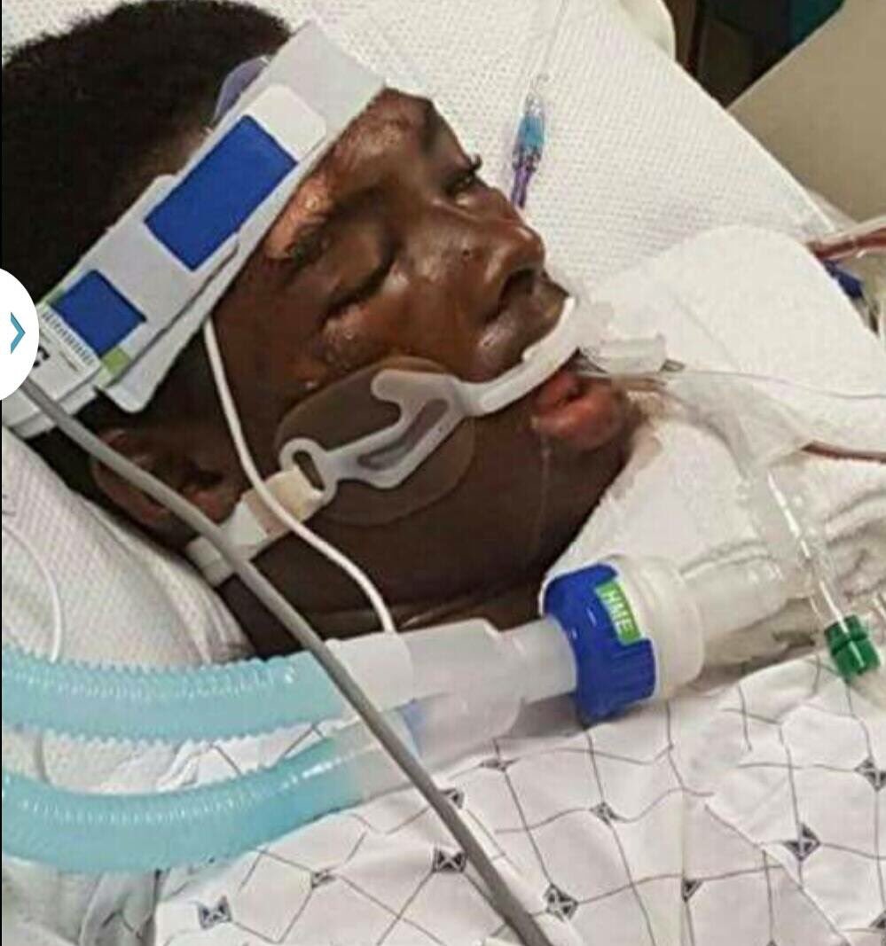 RIP #TawonBoyd has passed after being beaten unconscious by police in the Baltimore area. He called police because of a break in.