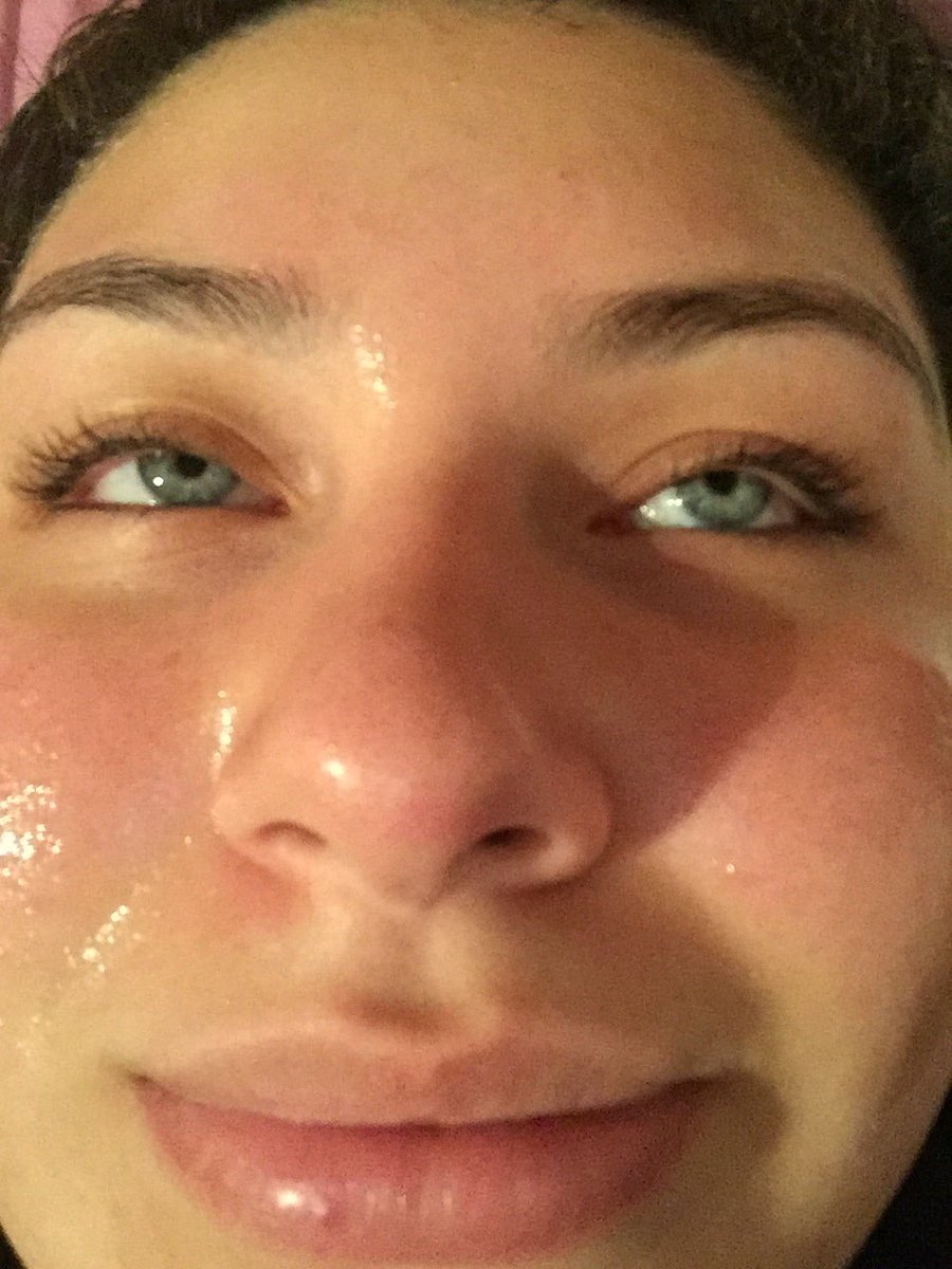 COLDBESSON's tweet photo. @JonahMarais me waiting for u to see this! btw my face isn't that greasy i have cream stuff on it #NextExGFin2Days https://t.co/TTmH9HHy9h