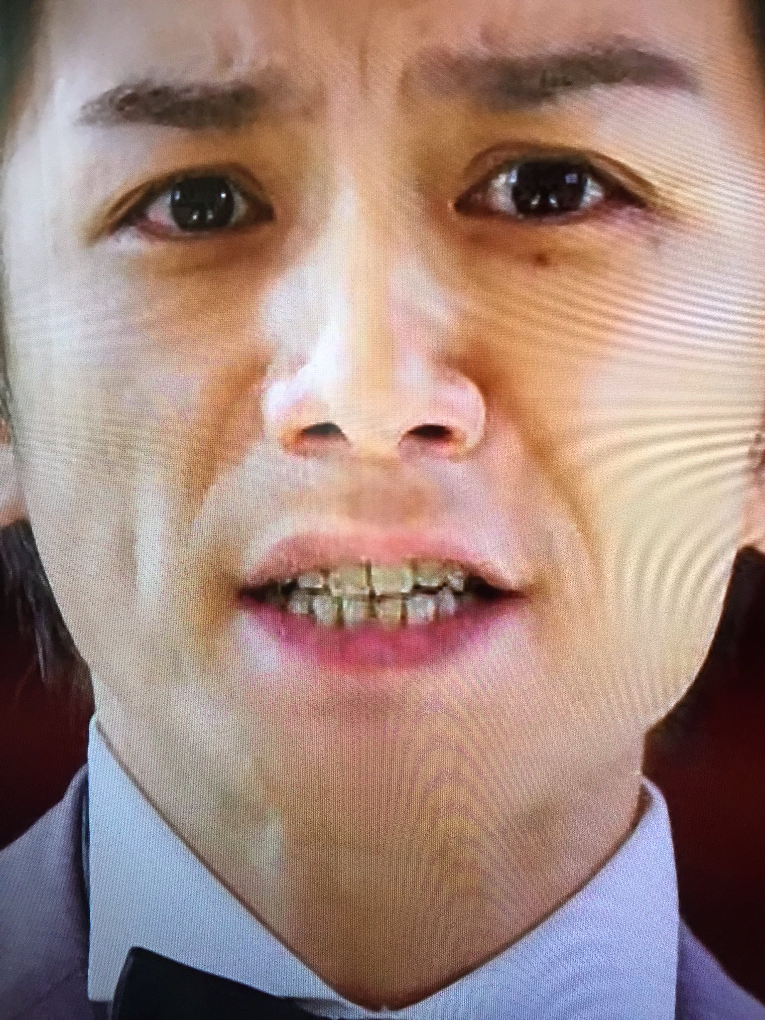 Hana 目頭切開dt タッキー歯が汚い みんな 歯並び云々の前にホワイトニングやで せいせい T Co 8lzcgrjutf Twitter