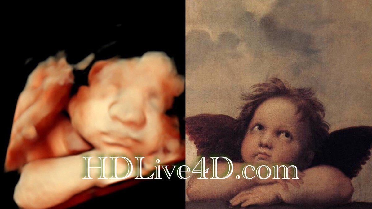 3Dand4Dtech's tweet photo. Who said angels don't exist here on earth? #HDLive4D #pregnant #DC #NoVa #Fairfax #Loudoun #Leesburg #Purcellville #Aldie #South Riding https://t.co/VILYRGLmlY
