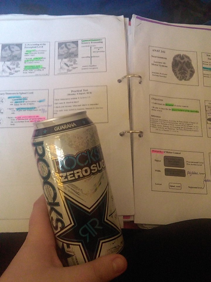 _dopaMEAN's tweet photo. @nataliemwall feeling ya. Neuro test tomorrow :( #ImNotReadyToDie @pagerkryptonite https://t.co/Axw5xIURRv