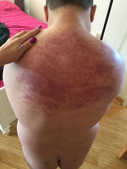 My human facesitting swing couldn't please Me, so I did something I know would get Me off, no fake #flogging<a href="/tag/flogging"class="tags"><span>#flogging</span></a>