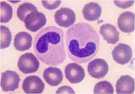 Don_Guiot's tweet photo. Presencia de banda en sangre indica infección aguda. #PFisiopatologicos https://t.co/uQeFHdGVaZ