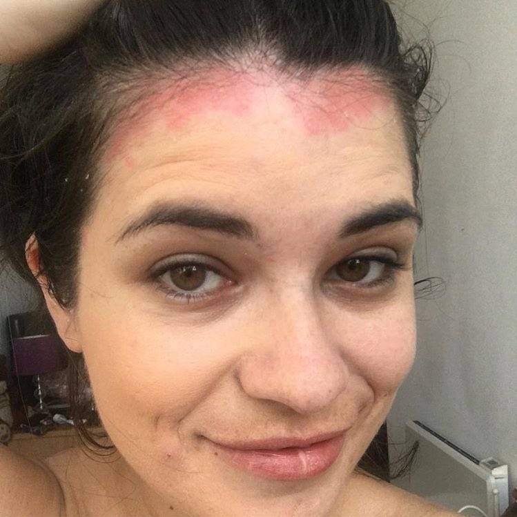 Fix my psoriasis tweet media
