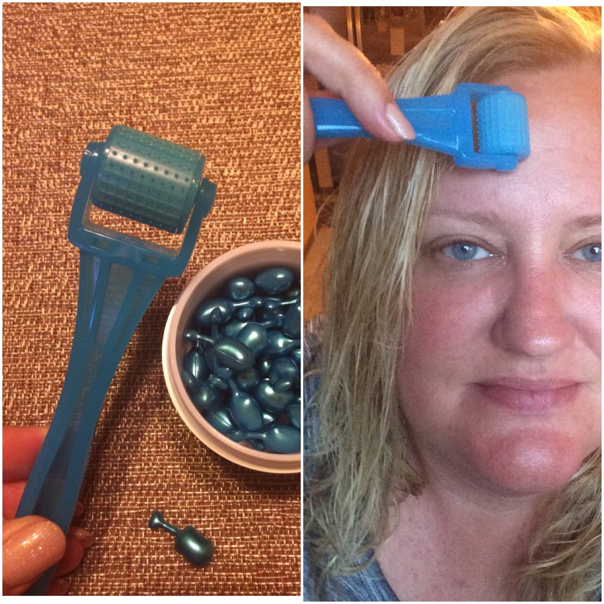 jwurzer277's tweet photo. My secret anti aging tool, the #Amproller from #RodanandFields #WrinkleEraser https://t.co/JJu8xgPxcA