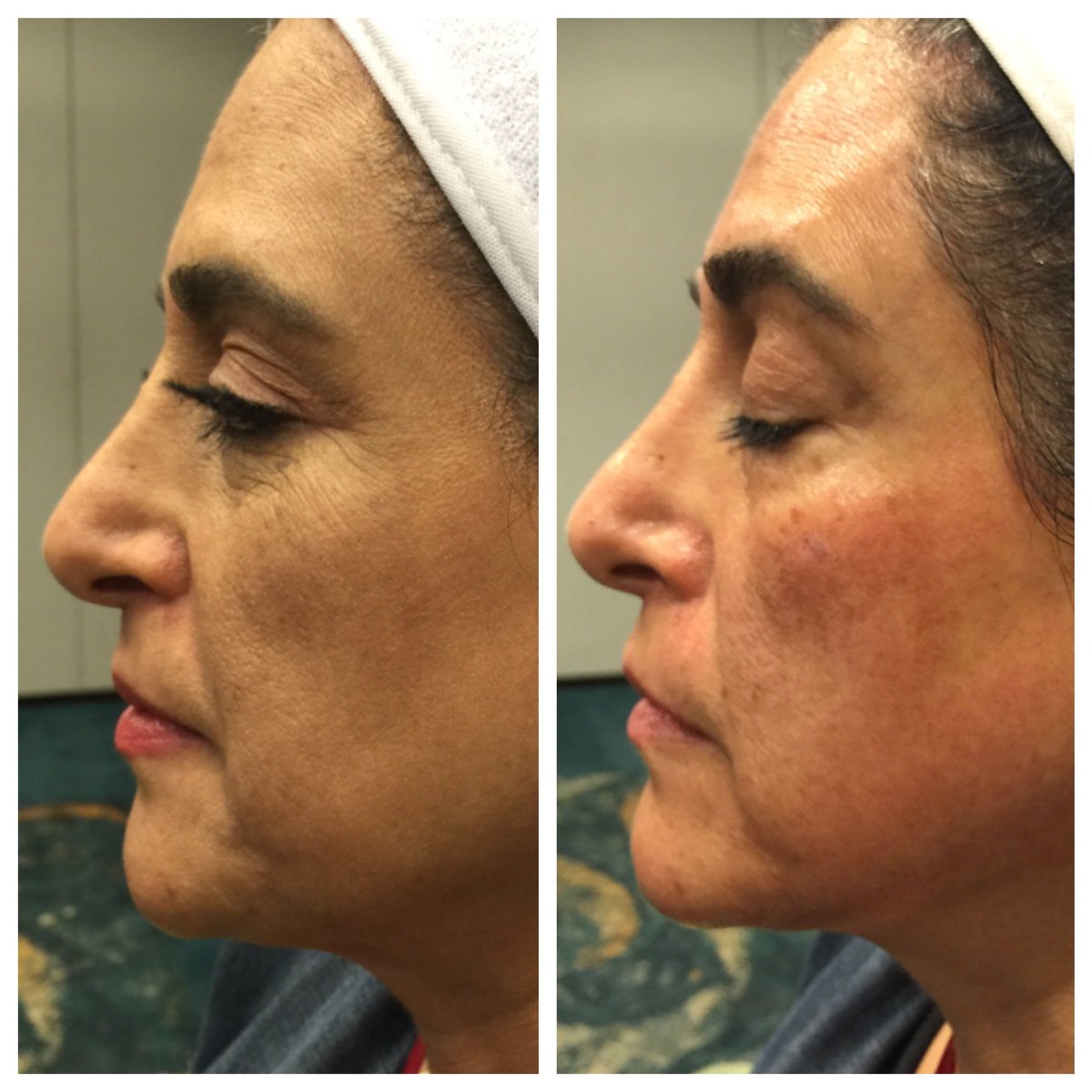 NaturePureLabs's tweet photo. #GoodMorning #LongBeachCongress Recap on yesterday #Menopause #AgeReversing Treatment Demo Photos #beauty #skincare https://t.co/su7x2Kdacb
