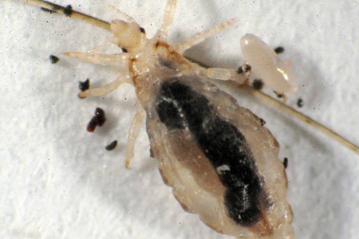 Elimilice's tweet photo. Expert says, parents have to be wary of super head lice resistant to traditional treatments.
https://t.co/vns9YIq1wb https://t.co/jG5BwE0wnS