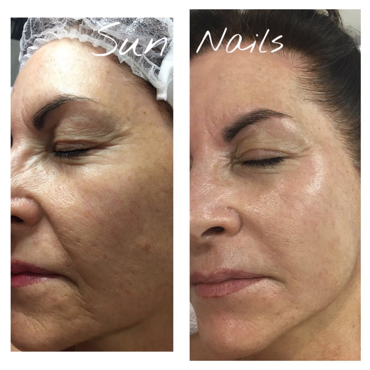 esteticSunNails's tweet photo. Después de unos días de descanso, el miércoles comenzamos con más fuerzas.
Y como no, con #dermia de @skinfaktor https://t.co/nmHbEAYbIQ
