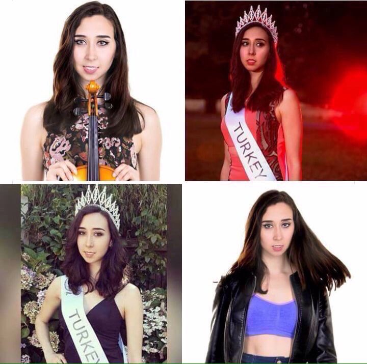 #MissTurkey .UstDudak {
    display:none;
}