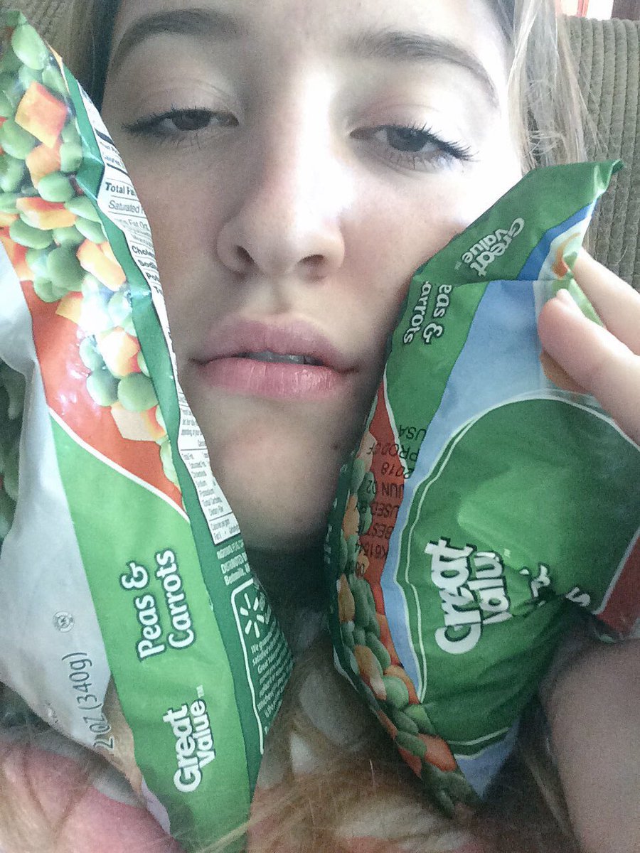 hannahjeanrose's tweet photo. I got my teeth ripped out #ripwisdom https://t.co/8bXBV0sfni
